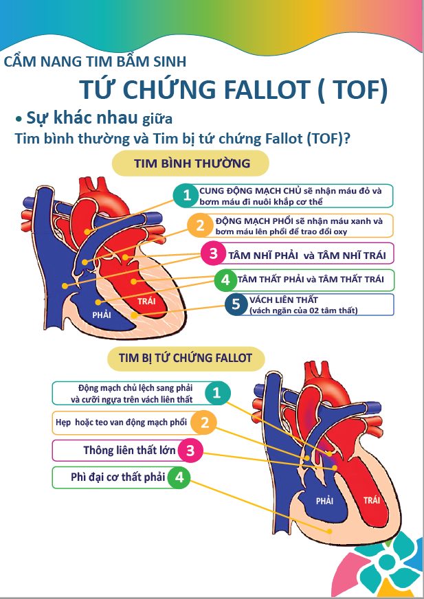 Tứ chứng fallot